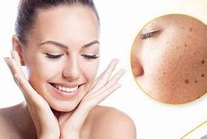  SKIN PIGMENTATION TREATMENT
