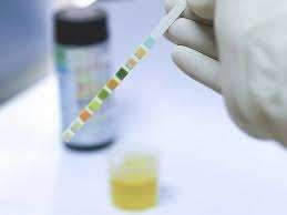 Urine Test