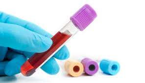 Blood Test