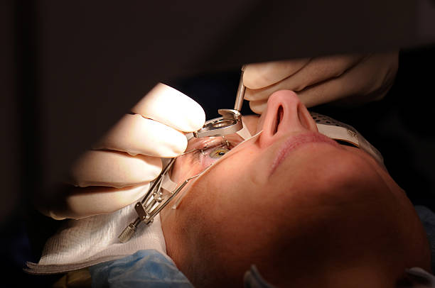 LASIK / REFRACTIVE SURGERIES