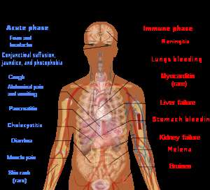 Leptospirosis