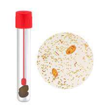 Stool Test